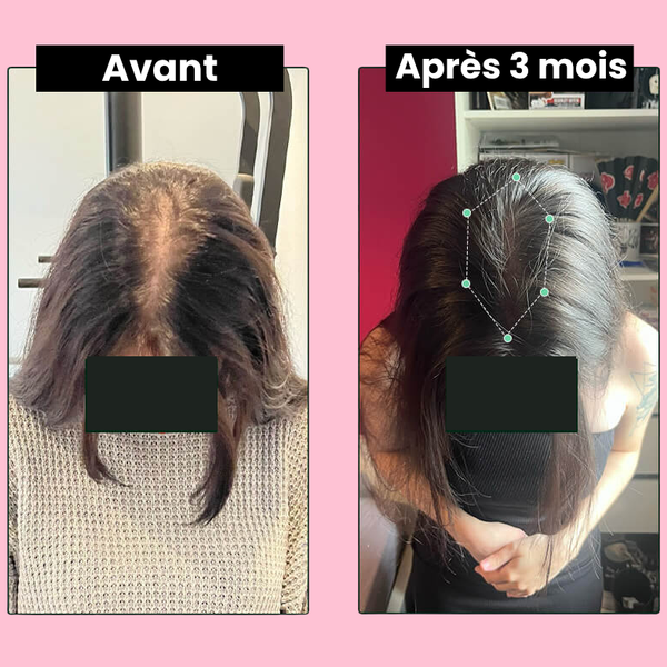 Florelle Repousse Extrême