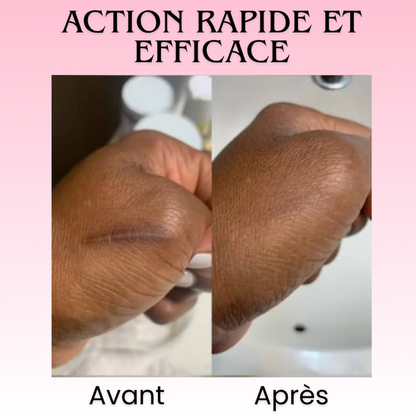 Florelle Anti cicatrices